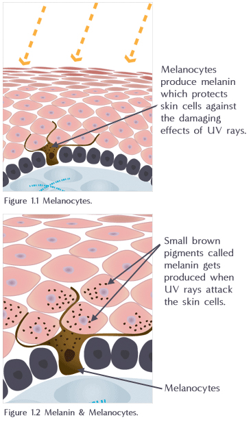 Hyper Pigmentation Illustration